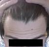 Click image for larger version

Name:	hairlineangle2012.jpg

Size:	31.5 KB
ID:	16470