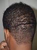 Click image for larger version

Name:	After FUE Donor Scar.jpg

Size:	97.0 KB
ID:	8946