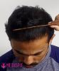 Click image for larger version

Name:	23_Comb Hairline.jpg

Size:	79.7 KB
ID:	67434