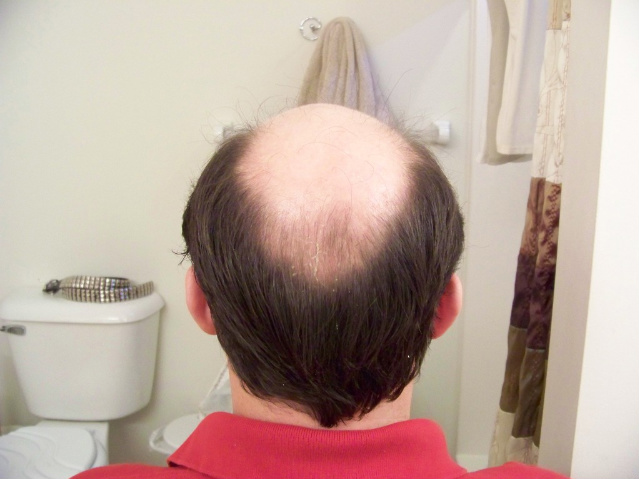 Click image for larger version

Name:	BackHair.jpg

Size:	97.1 KB
ID:	1093