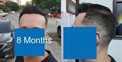 Click image for larger version

Name:	hairline at 8 months.jpg

Size:	20.6 KB
ID:	68152