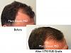 Click image for larger version

Name:	Hair Transplant Slides copy52.003.jpg

Size:	13.2 KB
ID:	46704