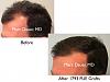 Click image for larger version

Name:	Hair Transplant Slides copy52.002.jpg

Size:	12.7 KB
ID:	46705