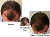Click image for larger version

Name:	Hair Transplant Slides copy52.004.jpg

Size:	15.6 KB
ID:	46706