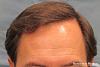 Click image for larger version

Name:	03_after-hair-repair-front.jpg

Size:	21.2 KB
ID:	21208