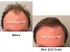 Click image for larger version

Name:	Hair Transplant Slides3.001.jpg

Size:	12.6 KB
ID:	42439