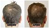 Click image for larger version

Name:	Before-After-Crown1.jpg

Size:	94.2 KB
ID:	72683