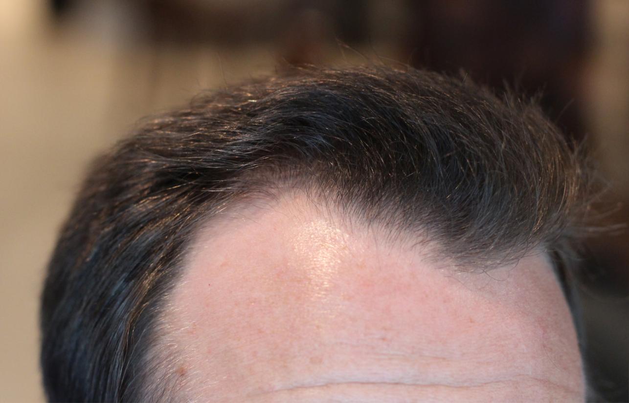 Click image for larger version

Name:	07-dry-cowlick-closeup.jpg

Size:	90.4 KB
ID:	26020