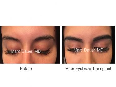 Click image for larger version

Name:	eyebrow mandii.001.jpg

Size:	11.2 KB
ID:	51270