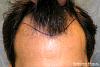 Click image for larger version

Name:	04_position-of-hairline.jpg

Size:	94.9 KB
ID:	44734