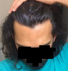 Click image for larger version

Name:	Hairline.jpg

Size:	9.9 KB
ID:	48173