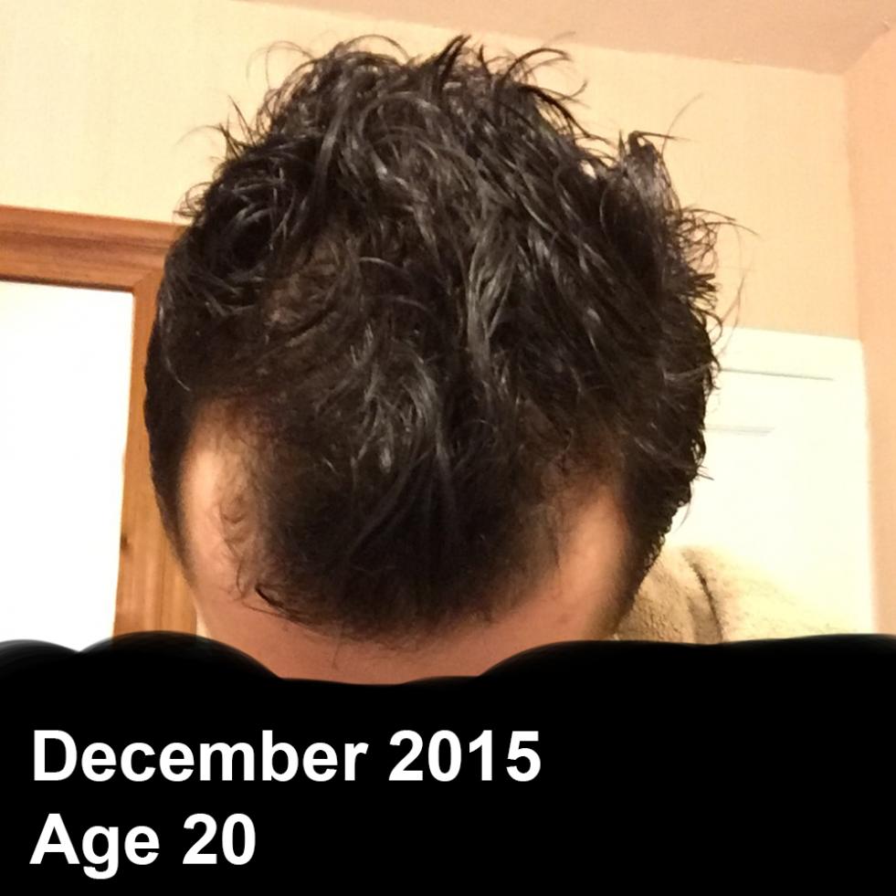 Dec2015Age20