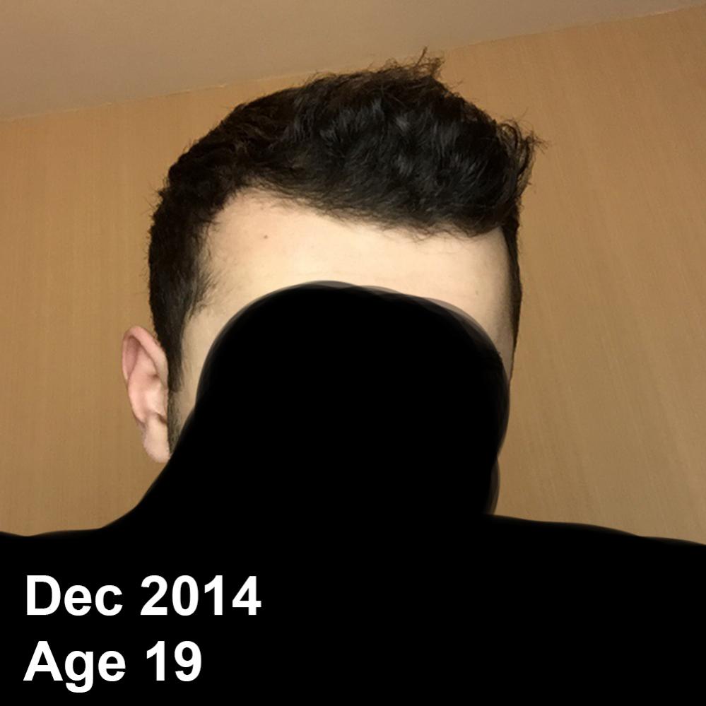 Dec2014Age19