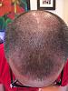 Click image for larger version

Name:	hair-10day-post-top.jpg

Size:	95.0 KB
ID:	58507