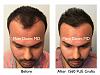 Click image for larger version

Name:	Hair Transplant Slides copy113.001.jpg

Size:	16.9 KB
ID:	48326