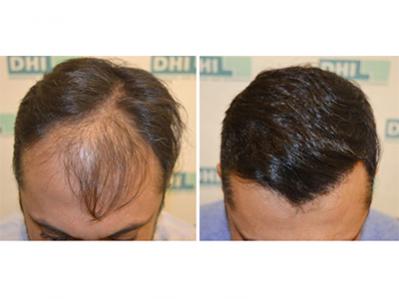 aman lal, 14 month result