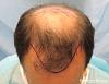 Click image for larger version

Name:	1096_11_3b_position-of-hairline-top-view.jpg

Size:	24.2 KB
ID:	24048