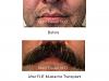 Click image for larger version

Name:	mustache fue.001.jpg

Size:	12.2 KB
ID:	58283