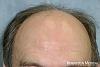 Click image for larger version

Name:	hairline-b.jpg

Size:	68.3 KB
ID:	26308