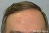 Click image for larger version

Name:	hairline-a3rd.jpg

Size:	68.4 KB
ID:	26310