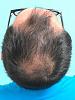 Click image for larger version

Name:	hair-before-top.jpg

Size:	50.5 KB
ID:	58392