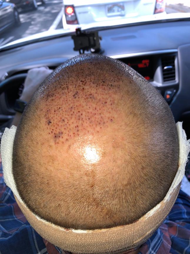 Click image for larger version

Name:	back of head.jpg

Size:	96.5 KB
ID:	56657