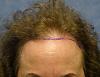 Click image for larger version

Name:	03_position-of-hairline.jpg

Size:	59.9 KB
ID:	16073