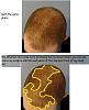 Click image for larger version

Name:	7 Current Hair Loss #2.jpg

Size:	50.2 KB
ID:	36895