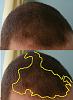 Click image for larger version

Name:	8 Current Hair Loss #3.jpg

Size:	85.7 KB
ID:	36896