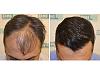 aman lal, 14 month result