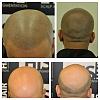 Click image for larger version

Name:	Shak hair loss journey .jpg

Size:	84.6 KB
ID:	55996