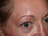 Click image for larger version

Name:	tammym-bef-eyebrows0.jpg

Size:	58.0 KB
ID:	3603