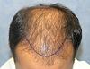 Click image for larger version

Name:	07_position-of-hairline-top.jpg

Size:	68.3 KB
ID:	6541