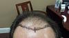Click image for larger version

Name:	picking the hairline.jpg

Size:	68.7 KB
ID:	34209