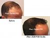 Click image for larger version

Name:	Hair Transplant Slides copy60.003.jpg

Size:	12.0 KB
ID:	46989