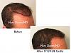 Click image for larger version

Name:	Hair Transplant Slides copy1111.004.jpg

Size:	12.6 KB
ID:	49414