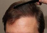 Hairline view