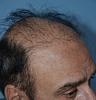 Click image for larger version

Name:	Darling Buds Hair transplant clinic India (3).jpg

Size:	90.0 KB
ID:	50289