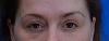 Click image for larger version

Name:	Cynthia eyebrows before.jpg

Size:	93.5 KB
ID:	56189