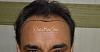 Click image for larger version

Name:	Darling Buds Clinic hair transplant pre op 1.jpg

Size:	92.0 KB
ID:	55395