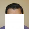 Click image for larger version

Name:	Dry hair front.jpg

Size:	29.8 KB
ID:	35881