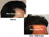 Click image for larger version

Name:	Hair Transplant Slides.477.jpg

Size:	58.8 KB
ID:	37445
