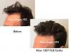 Click image for larger version

Name:	Hair Transplant Slides copy229.007.jpg

Size:	11.6 KB
ID:	49062