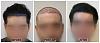 Click image for larger version

Name:	Hairline-9Months-Forum (1) copy.jpg

Size:	90.9 KB
ID:	72815