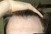 Click image for larger version

Name:	Front Hairline.jpg

Size:	67.5 KB
ID:	67406