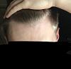 Click image for larger version

Name:	Front hairline 2.jpg

Size:	58.0 KB
ID:	67407