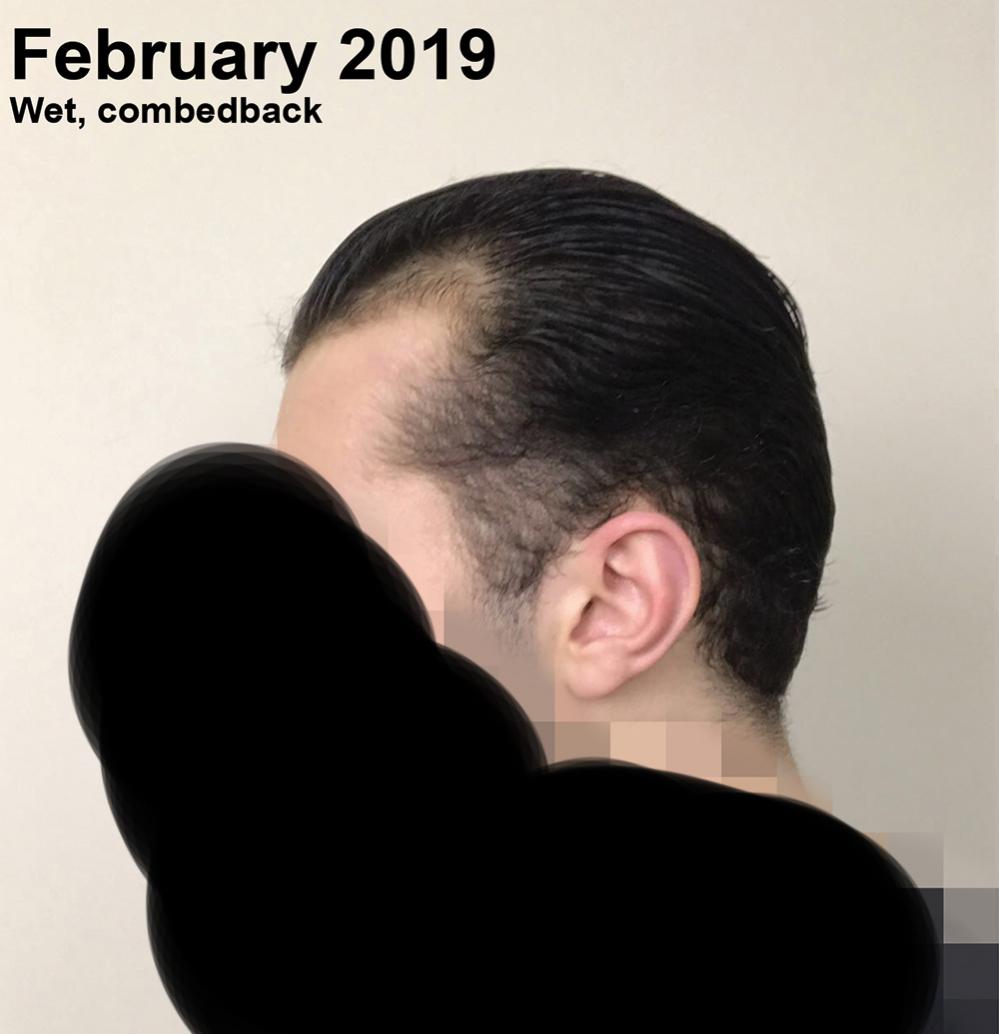 Feb2019 Side