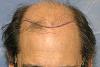 Click image for larger version

Name:	03_position-of-hairline.jpg

Size:	54.6 KB
ID:	8030