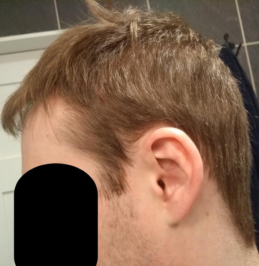 Hair left side