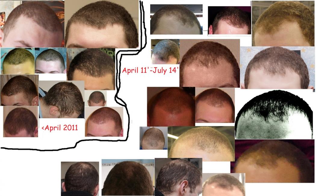 Click image for larger version

Name:	1 Hair Comparison.jpg

Size:	95.4 KB
ID:	36889